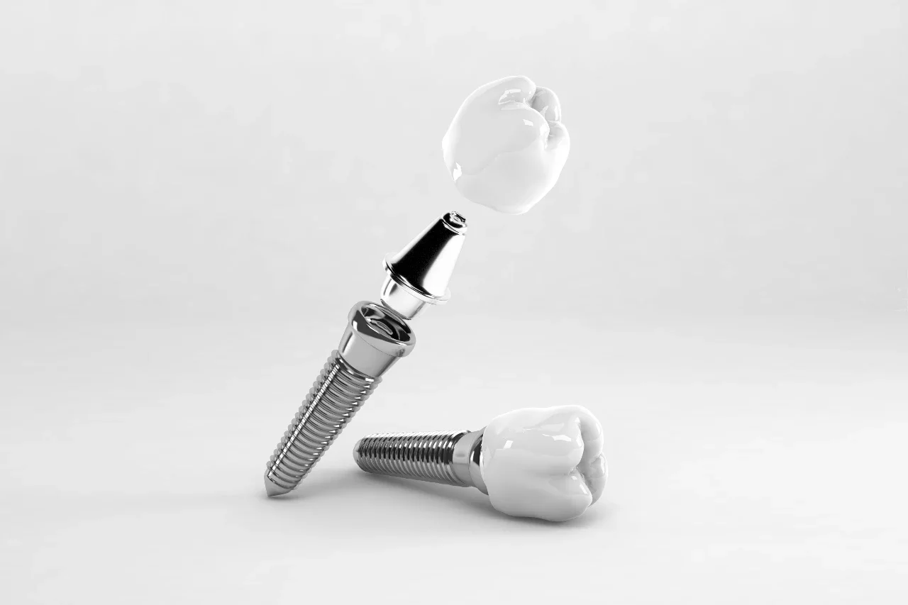 Dental implant